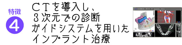 CTを導入し、3次元での診断