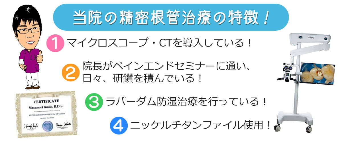 当院で根管治療をすべき理由！