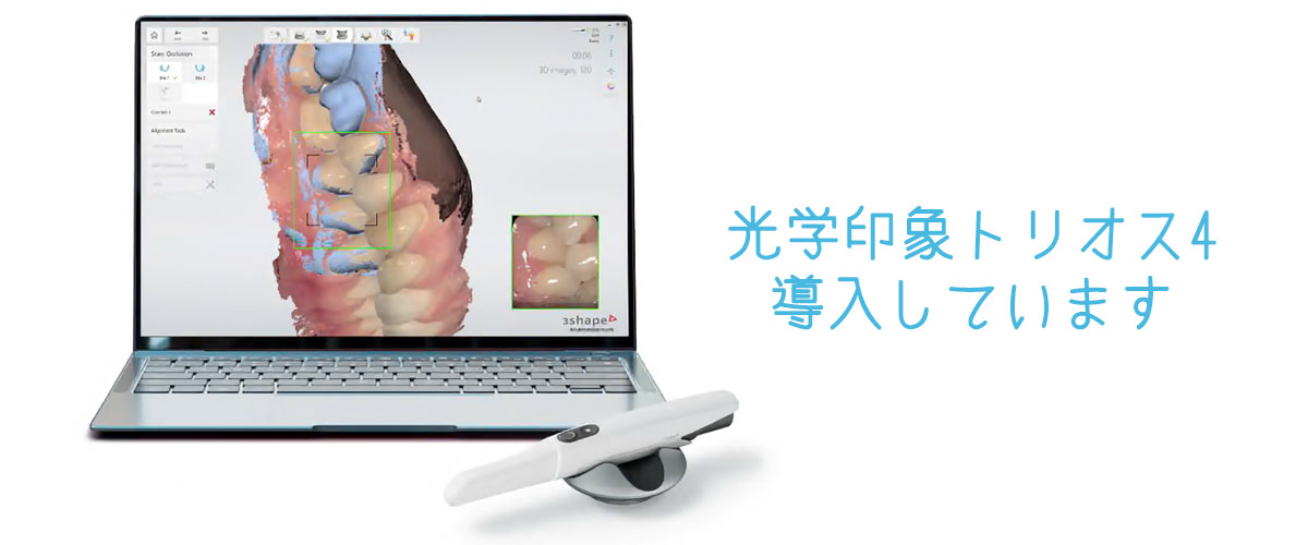 光学印象トリオス4導入しています